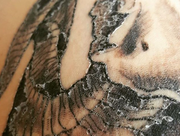 Tattoo Peeling 101 - Warum Ihre frisch eingefärbte Haut abplatzt  